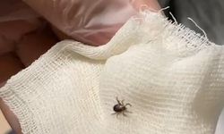 Eskişehir’de kene krizi: Hızlı müdahale hayat kurtardı