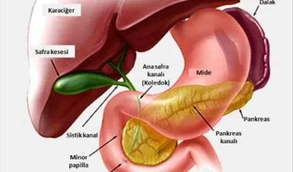 Eskişehir’de safra ve pankreas hastalıklarına cerrahisiz çözüm