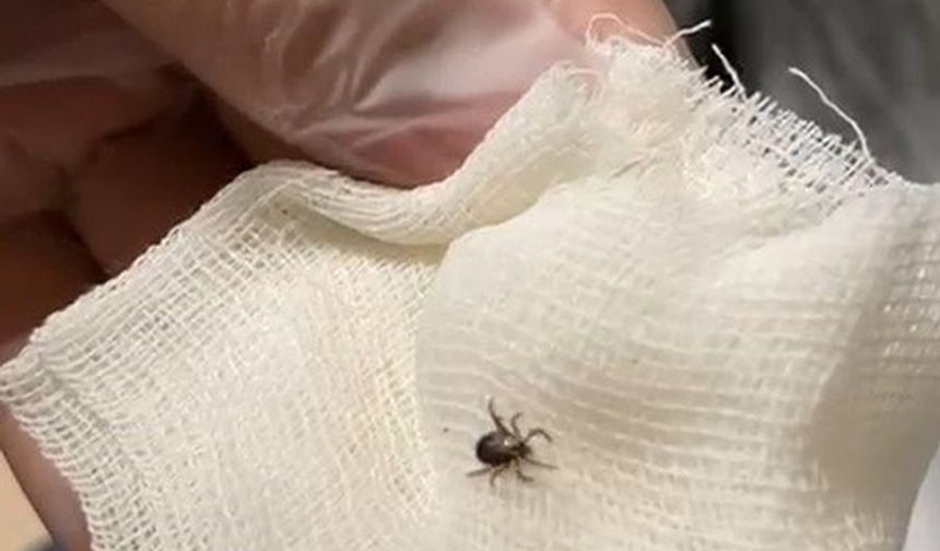 Eskişehir’de kene krizi: Hızlı müdahale hayat kurtardı