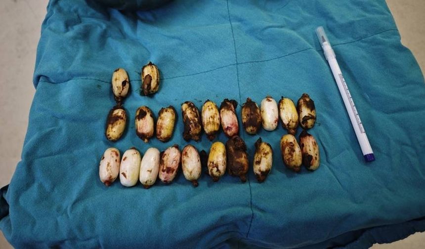 Yabancı uyruklu şahsın midesinden 44 kapsül narkotik madde çıktı!